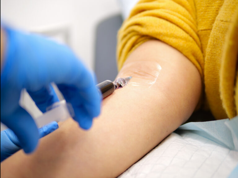 Gloved hand holding syringe of iron, adminstering into an arm.